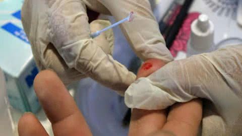 Testagem de HIV e sífilis acontecerá em Santos no próximo sábado - Imagem: reprodução Prefeitura de Santos