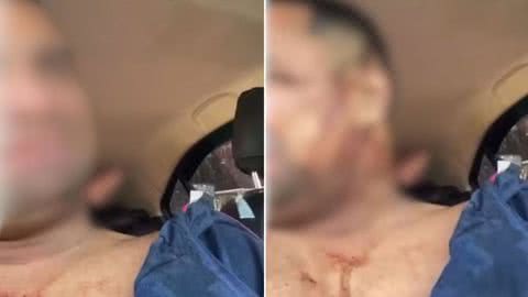 Motorista baleado. - Imagem: Reprodução | X (Twitter) - @Santaportal1