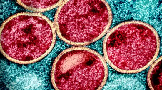 Baixada Santista registra aumento significativo de casos de mpox; entenda a situação - Imagem: Reprodução/Fotos Públicas