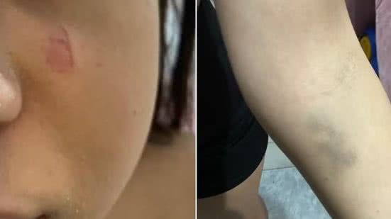 Briga familiar acaba em agressão brutal: jovem é atacada pela prima próxima à escola em São Vicente - Imagem: Reprodução/ g1