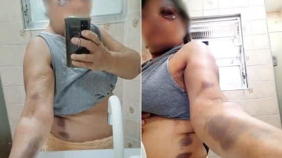 A profissional relata que o aluno tem um histórico agressivo - Imagem: Divulgação/ G1