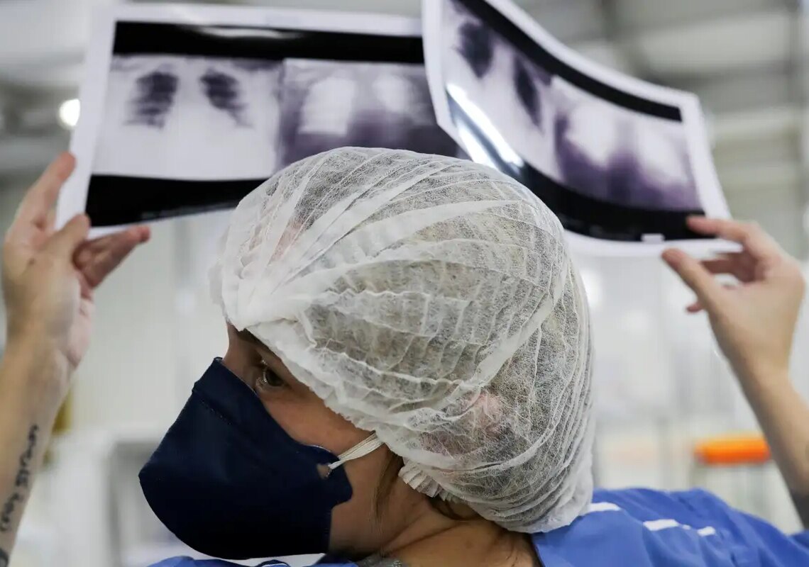 Câncer de pulmão: 15% dos casos acontecem em não fumantes