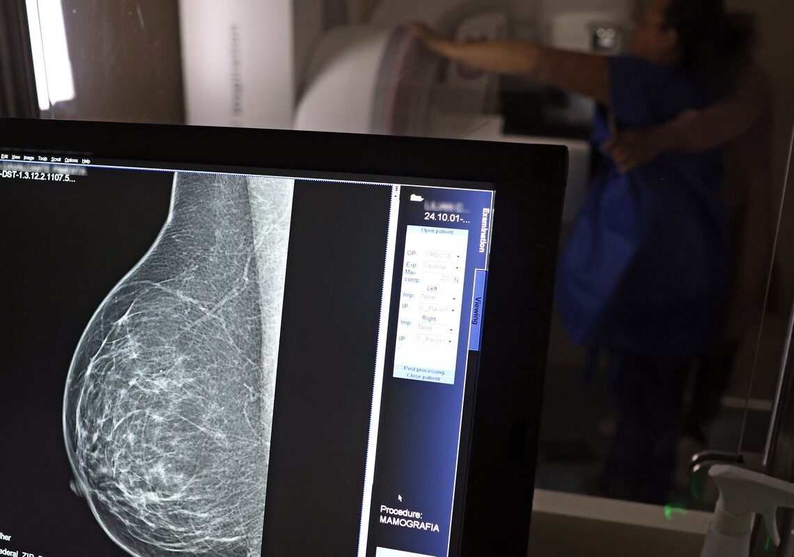 Ministério da Saúde passa a recomendar mamografia a partir dos 40 anos