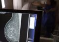 Ministério da Saúde passa a recomendar mamografia a partir dos 40 anos
