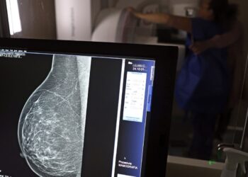 Ministério da Saúde passa a recomendar mamografia a partir dos 40 anos