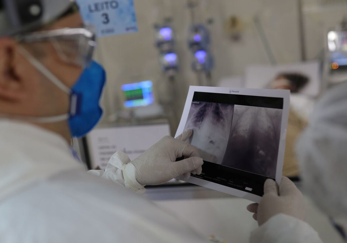 Covid é principal causa de internação por síndrome respiratória no Rio