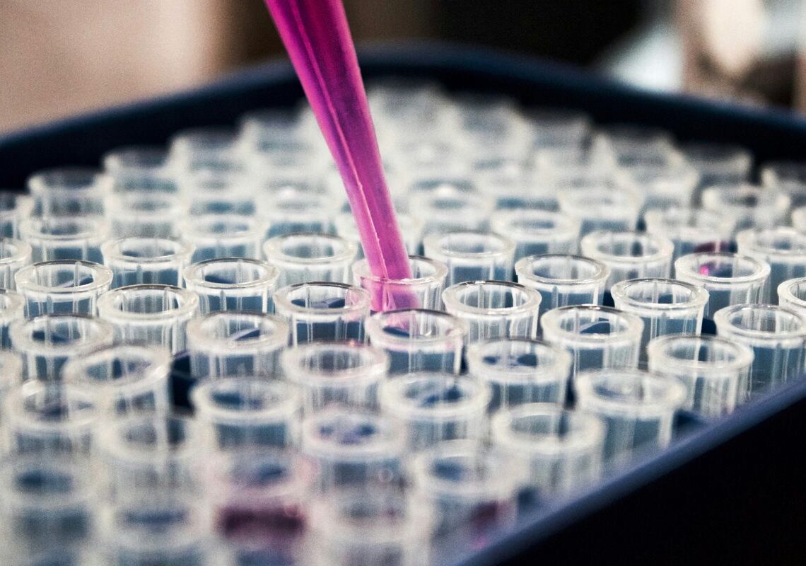 Pesquisas brasileiras avançam no diagnóstico de Alzheimer