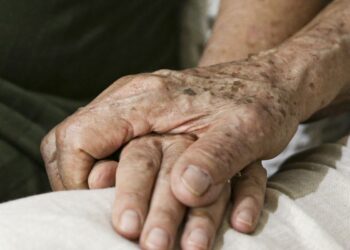 Demência por corpos de Lewy: entenda doença de Milton Nascimento