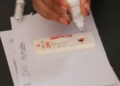 Ação no DF oferece testagem rápida e informação sobre HIV/Aids