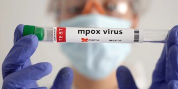 Secretaria de Saúde confirma segundo caso de mpox do grupo lp em SP