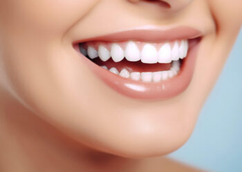 Até onde o clareamento dental funciona? O que limita o resultado do tratamento