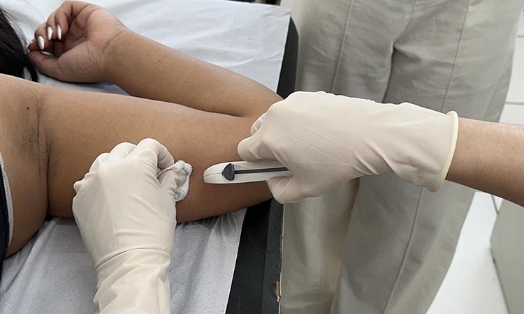 Mutirão de saúde aplica quase 900 implantes contraceptivos em Americana
