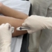 Mutirão de saúde aplica quase 900 implantes contraceptivos em Americana