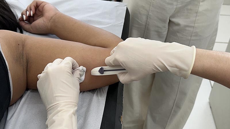 Mutirão de saúde aplica quase 900 implantes contraceptivos em Americana
